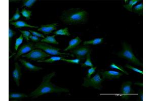 Immunofluorescence of purified MaxPab antibody to NMI on HeLa cell. (NMI Antikörper  (AA 1-307))