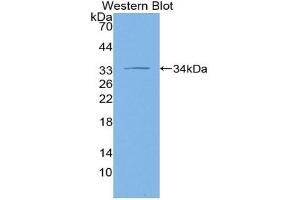 Western blot analysis of the recombinant protein. (ADCY1 Antikörper  (AA 303-569))