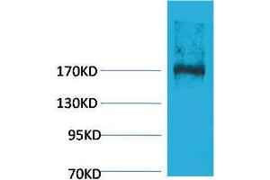 Western Blotting (WB) image for anti-Ectopic P-Granules Autophagy Protein 5 Homolog (EPG5) antibody (ABIN3181523) (EPG5 Antikörper)