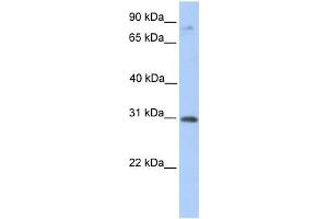 Human Placenta; WB Suggested Anti-ABHD13 Antibody Titration: 0. (ABHD13 Antikörper  (C-Term))