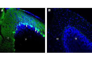 Expression of CD38 in mouse cerebellum. (CD38 Antikörper  (Extracellular))