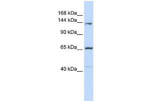 WB Suggested Anti-PCDH12 Antibody Titration:  0. (PCDH12 Antikörper  (Middle Region))