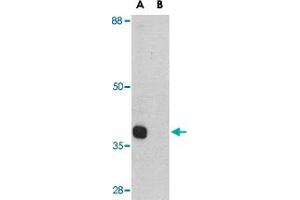 Western blot analysis of ATG12 in mouse heart tissue lysate with ATG12 polyclonal antibody  at 1 ug/mL in (A) the absence and (B) the presence of blocking peptide. (ATG12 Antikörper  (Internal Region))