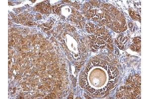 IHC-P Image Septin 2 antibody [N1N3] detects Septin 2 protein at cytosol on mouse ovary by immunohistochemical analysis. (Septin 2 Antikörper)