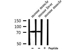 Western blot analysis of extracts from mouse muscle,mouse liver, using PABPC4 Antibody. (PABPC4 Antikörper  (Internal Region))