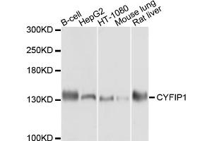 Western blot analysis of extracts of various cell lines, using CYFIP1 antibody. (CYFIP1 Antikörper)