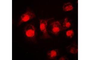 Immunofluorescent analysis of STAT3 staining in A549 cells. (STAT3 Antikörper  (C-Term))
