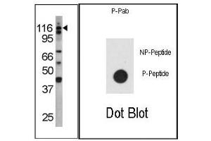 Image no. 1 for anti-Colony Stimulating Factor 2 Receptor, Beta (CSF2RB) (pTyr766) antibody (ABIN358147) (CD131 Antikörper  (pTyr766))