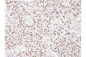 anti-Squamous Cell Carcinoma Antigen Recognized By T Cells 3 (SART3) (AA 600-650) antibody