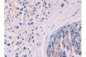Immunohistochemistry (IHC) image for anti-Single Immunoglobulin and Toll-Interleukin 1 Receptor (TIR) Domain (SIGIRR) (AA 1-118) antibody (ABIN7437203)