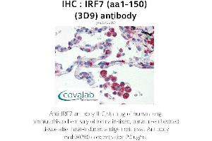 Image no. 2 for anti-Interferon Regulatory Factor 7 (IRF7) (AA 1-150) antibody (ABIN1723206) (IRF7 Antikörper  (AA 1-150))