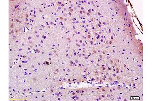 Formalin-fixed and paraffin embedded rat brain labeled with Anti JMY Polyclonal Antibody, Unconjugated (ABIN872348) at 1:200 followed by conjugation to the secondary antibody and DAB staining (JMY Antikörper  (AA 401-500))