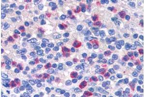 Human Spleen: Formalin-Fixed, Paraffin-Embedded (FFPE) (PGLYRP1 Antikörper  (AA 179-189))