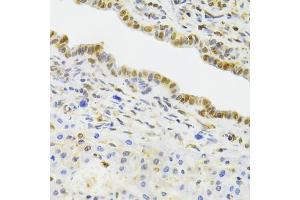 Immunohistochemistry of paraffin-embedded rat liver using EFTUD2 Antibody (ABIN5974236) at dilution of 1/100 (40x lens). (EFTUD2 Antikörper)