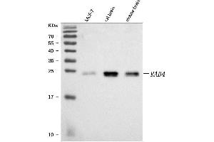 Western blot analysis of Rab4/RAB4A using anti-Rab4/RAB4A antibody (ABIN7599733).