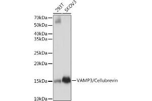Western blot analysis of extracts of various cell lines, using V/V/Cellubrevin Rabbit mAb (ABIN7271314) at 1:1000 dilution. (VAMP3 Antikörper)