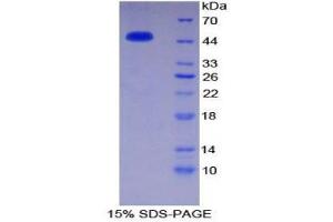 SDS-PAGE (SDS) image for Serpin Family C Member 1 (SERPINC1) (AA 33-464) protein (His tag) (ABIN1525353)