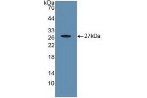 Detection of Recombinant CYR61, Human using Polyclonal Antibody to Cysteine Rich Protein, Angiogenic Inducer 61 (CYR61)