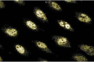 Immunofluorescence (IF) image for anti-Polymerase (DNA Directed), delta 1, Catalytic Subunit 125kDa (POLD1) (AA 60-261) antibody (ABIN968287)