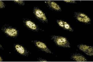 Immunofluorescence staining of Human Endothelial cells. (POLD1 Antikörper  (AA 60-261))