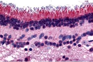 Human Retina (formalin-fixed, paraffin-embedded) stained with PTPRM antibody ABIN297531 at 16 ug/ml followed by biotinylated goat anti-rabbit IgG secondary antibody ABIN481713, alkaline phosphatase-streptavidin and chromogen. (PTPRM Antikörper  (Internal Region))
