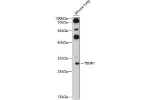 Immunofluorescence analysis of HeLa cells using TIMP1 antibody (ABIN6128284, ABIN6149176, ABIN6149177 and ABIN6218052) at dilution of 1:100. (TIMP1 Antikörper  (AA 24-207))