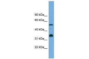 CYP26B1 antibody used at 1 ug/ml to detect target protein. (CYP26B1 Antikörper  (Middle Region))