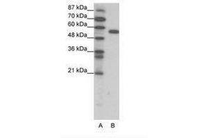 Image no. 1 for anti-Forkhead Box C2 (MFH-1, Mesenchyme Forkhead 1) (FOXC2) (AA 412-461) antibody (ABIN202668) (FOXC2 Antikörper  (AA 412-461))