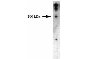 Western blot analysis of Dynamin II on a HeLa cell lysate (Human cervical epitheloid carcinoma, ATCC CCL-2) using 1 µg/mL of the Mouse Anti-Dynamin II antibody. (DNM2 Antikörper  (AA 274-555))