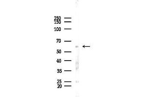 Western blot analysis of lysates from PC12 cells, using ZNF248 Antibody at 1/1000 dilution.