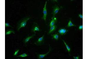Immunofluorescence staining of U251 cells with ABIN7159457 at 1:66, counter-stained with DAPI.