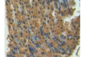 Immunohistochemistry (IHC) image for anti-S100 Calcium Binding Protein A1 (S100A1) (AA 2-94) antibody (ABIN7430387)