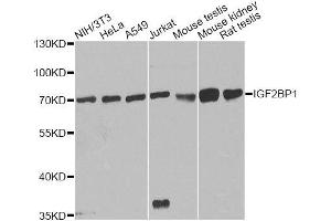 Western blot analysis of extracts of various cell lines, using IGF2BP1 antibody. (IGF2BP1 Antikörper  (C-Term))