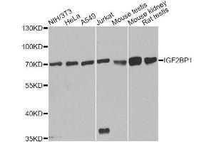 Western blot analysis of extracts of various cell lines, using IGF2BP1 antibody.