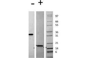 SDS-PAGE of Mouse Platelet Derived Growth Factor AA Recombinant Protein SDS-PAGE of Mouse Platelet Derived Growth Factor-AA Recombinant Protein.