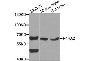 Western blot analysis of extracts of various cell lines, using P4HA2 antibody. (P4HA2 Antikörper  (AA 234-533))