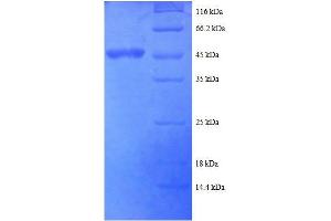 Adenosine Deaminase, RNA-Specific (ADAR) (AA 1-176), (partial) protein (GST tag) (ADAR Protein (AA 1-176, partial) (His-SUMO Tag))