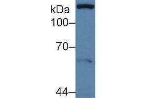 Western blot analysis of Human MCF7 cell lysate, using Human Pax Antibody (3 µg/ml) and HRP-conjugated Goat Anti-Rabbit antibody ( (Paxillin Antikörper  (AA 201-461))