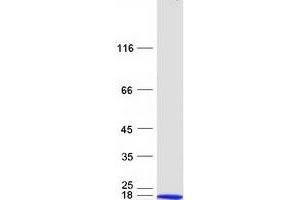 Validation with Western Blot (NME2 Protein (Transcript Variant 4) (Myc-DYKDDDDK Tag))