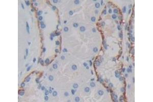 IHC-P analysis of Human Tissue, with DAB staining. (IL18RAP Antikörper  (AA 310-451))