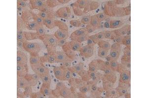 IHC-P analysis of Human Tissue, with DAB staining. (SMOX Antikörper  (AA 1-165))