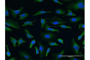 Immunofluorescence of monoclonal antibody to USP9X on HeLa cell. (USP9X Antikörper  (AA 1-90))
