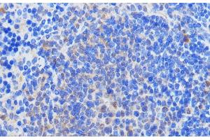 Immunohistochemistry (Paraffin-embedded Sections) (IHC (p)) image for anti-RNA Binding Motif Protein 39 (RBM39) antibody (ABIN7258648)