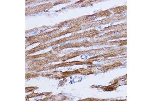 Immunohistochemistry (IHC) image for anti-NADH Dehydrogenase (Ubiquinone) 1 beta Subcomplex, 7, 18kDa (NDUFB7) (AA 1-137) antibody (ABIN6144480)