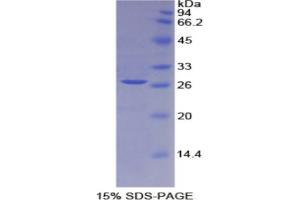 SDS-PAGE analysis of Rat IL2Ra Protein. (CD25 Protein)