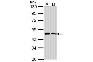 WB Image Sample (30 ug of whole cell lysate) A: A431 , B: H1299 10% SDS PAGE antibody diluted at 1:1000 (SIL1 Antikörper  (C-Term))