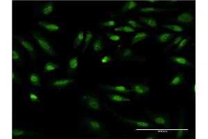 Immunofluorescence (IF) image for anti-G Protein-Coupled Receptor Kinase Interactor 2 (GIT2) (AA 1-471) antibody (ABIN564231)