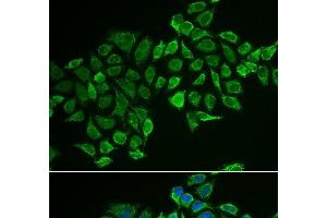 Immunofluorescence analysis of MCF-7 cells using RHOD Polyclonal Antibody