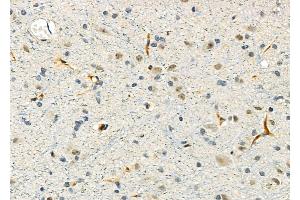ABIN6260784 and ABIN6276639 at 1/100 staining Rat brain tissue by IHC-P. (CGA Antikörper  (Internal Region))
