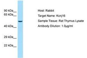 Image no. 1 for anti-Potassium Inwardly-Rectifying Channel, Subfamily J, Member 16 (KCNJ16) (AA 280-329) antibody (ABIN6749836) (KIR5.1 Antikörper  (AA 280-329))